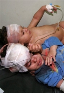 injured_children_in_gaza_strip1